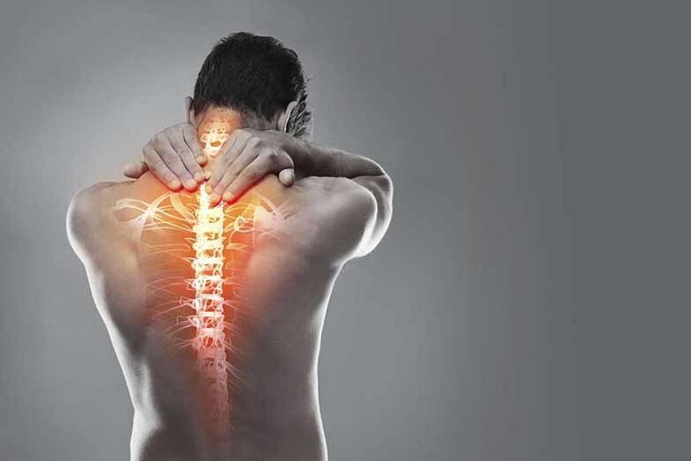 Osteochondroza v oblasti děložního čípku