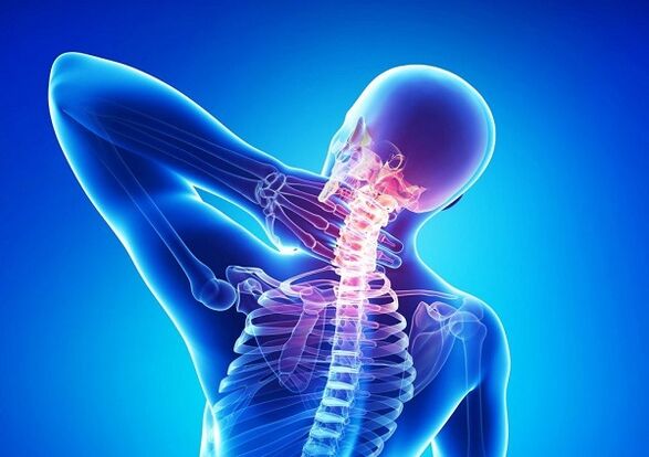 bolest v krční páteři s osteochondrosou