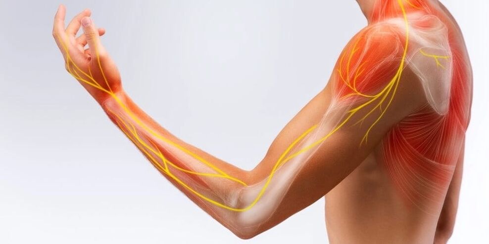 Bolest a necitlivost prstů svědčí o poškození vazů v důsledku stenózní ligamentitidy